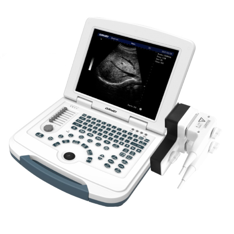 Echographe numérique portable