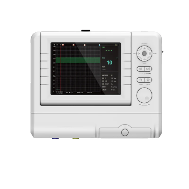 Cardiotocographe - Monitoring foetal 2