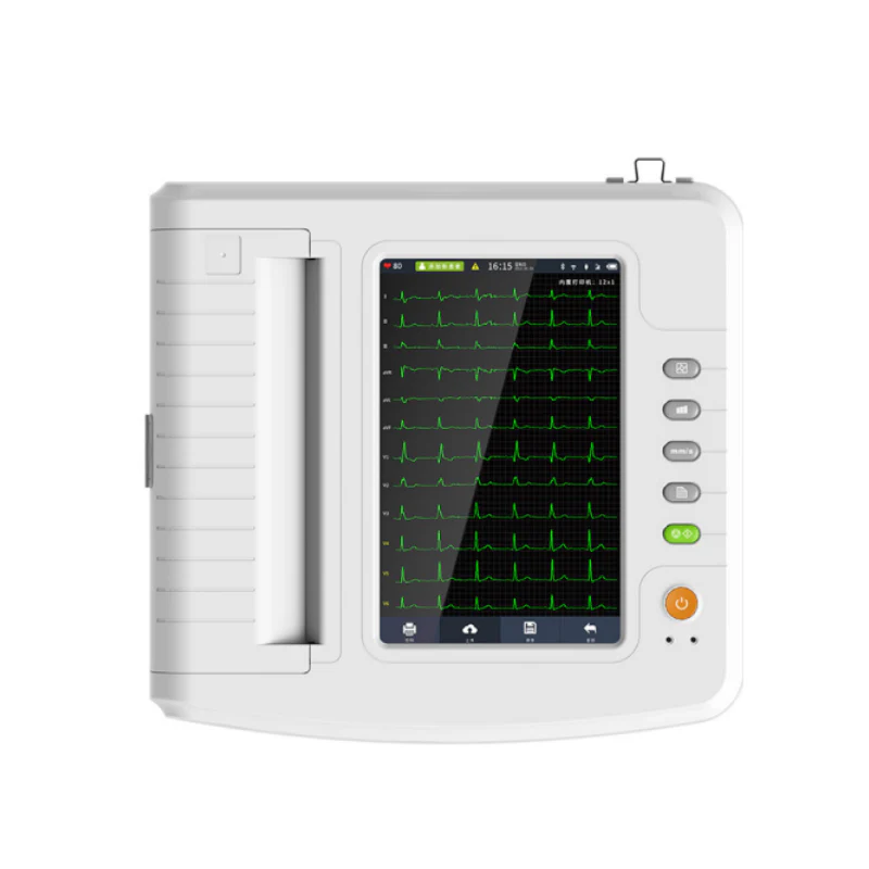 ECG 12 pistes avec interprétation - Contec 2