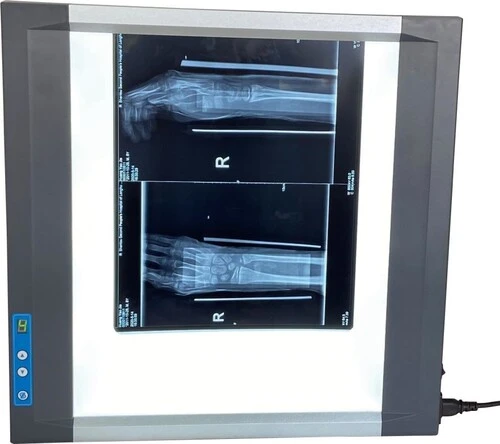Négatoscope Ultra-Fin LED 2