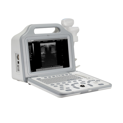 Echographe portable blanc et noir avec doppler pulsé sur chariot- EMP
