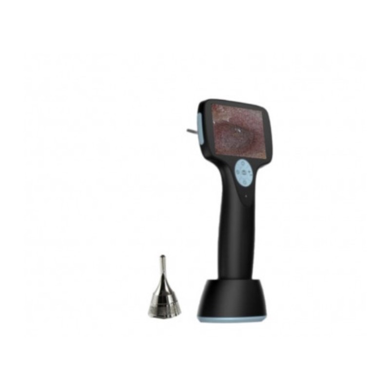 OTOSCOPE VIDEO DIGISKOP AUG
